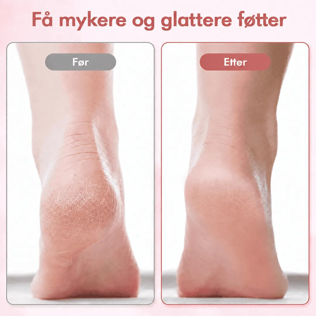 FeetCleanse™ | Oppladbar elektrisk fotfil